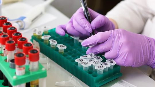 Brytyjscy naukowcy zachęcają do szybszego zatwierdzania nowych szczepionek