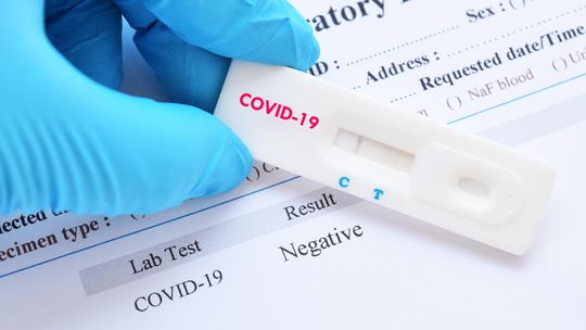 Covid-19: Liczba zakażeń na koronawirusa wciąż maleje