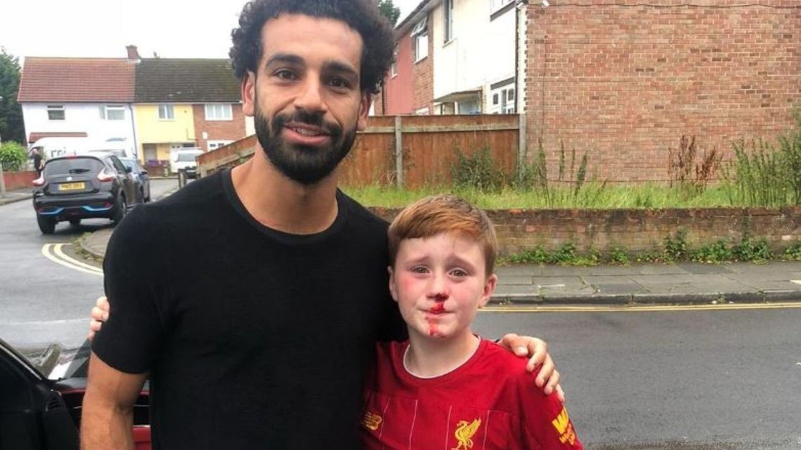 Mo Salah pozuje z 11-letnim chłopcem, który złamał nos próbując go zobaczyć