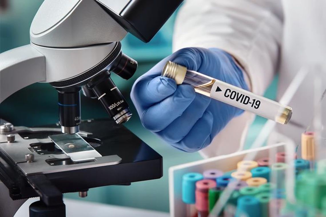 Najwięcej nowych zakażeń koronawirusem od prawie czterech tygodni - 33,9 tys.