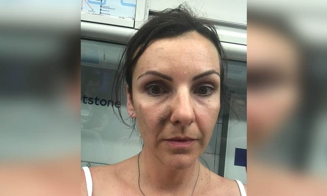 Szyja kobiety utknęła w drzwiach wagonu metra